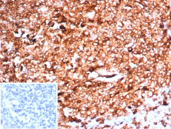 IHC staining of FFPE human tonsil tissue with HLA