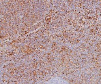 IHC staining of FFPE human tonsil tissue with HLA-ABC antibody (clone MHC-I/8366R). HIER: boil tissue sections in pH 9 10mM Tris with 1mM EDTA for 20 min and allow to cool before testing.~