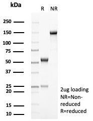 SDS-PAGE analysis of purified, BSA-free HLA-DR (HLA-DRA/8287R) as confirmation of