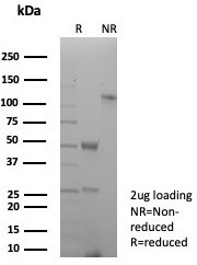 SDS-PAGE analysis of purified, BSA-free Pan-HLA antibody (clone rHLA-Pan/8847) as con
