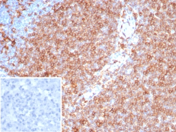 IHC staining of FFPE human tonsil tissue with Pan-HLA-II antibody (clone HLA-Pan/8311R). Inset: PBS used in place of primary Ab (secondary Ab negative control). HIER: boil tissue sections in pH 9 10mM Tris with 1mM EDTA for 20 min and allow to cool before testing.~
