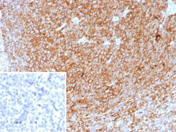 IHC staining of FFPE human tonsil tissue with HLA-DP/DQ/DR antibody (clone HLA-Pan/8622R). Inset: PBS used in place of primary Ab (secondary Ab negative control). HIER: boil tissue sections in pH 9 10mM Tris with 1mM EDTA for 20 min and allow to cool before testing.~