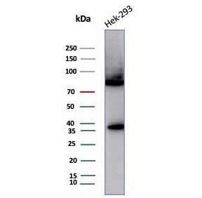Western blot testing of human HEK293 cell lysate with Heat shock 70 kDa protein 1B antibody (clone HSPA1B/7629). Expected molecular weight ~70 kDa.~