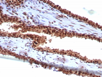 IHC staining of FFPE human prostate tissue with Heat shock 70 kDa protein 1B antibody (clo