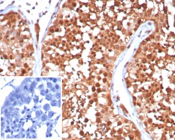 IHC staining of FFPE human testis tissue with HSP70-1A antibody (clone HSPA1A/7932). Inset: PBS used in place of primary Ab (secondary Ab negative control). HIER: boil tissue sections in pH 9 10mM Tris with 1mM EDTA for 20 min and allow to cool before testing.~