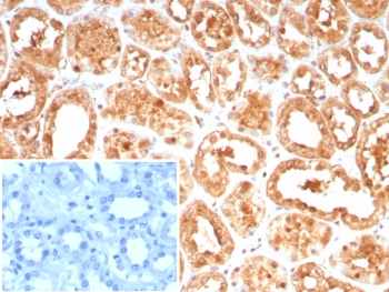 IHC staining of FFPE human kidney tissue with HSPA1A antibody (clone HSPA1A/7936). Inset: PBS used in place of primary Ab (secondary Ab negative control). HIER: boil tissue sections in pH 9 10mM Tris with 1mM EDTA for 20 min and allow to cool before testing.~