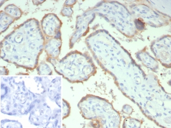 IHC staining of FFPE human placental tissue with HCG-beta antibody (clone hCGa/7873). Inset: PBS used in place of primary Ab (secondary Ab negative control). HIER: boil tissue sections in pH 9 10mM Tris with 1mM EDTA for 20 min and allow to cool before testing.~