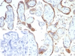 IHC staining of FFPE human placental tissue with HCG-beta antibody (clone hCGa/7874). Inset: PBS used in place of primary Ab (secondary Ab negative control). HIER: boil tissue sections in pH 9 10mM Tris with 1mM EDTA for 20 min and allow to cool before testing.