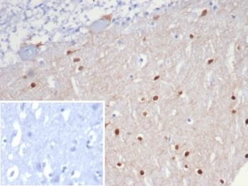 IHC staining of FFPE human brain tissue with SCGN antibody (clone SCGN/7326). Inset: PBS used in place of primary Ab (secondary Ab negative control). HIER: boil tissue sections in pH 9 10mM Tris with 1mM EDTA for 20 min and allow to cool before testing.~