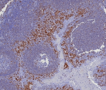 IHC staining of FFPE human tonsil tissue with IRF4 ant