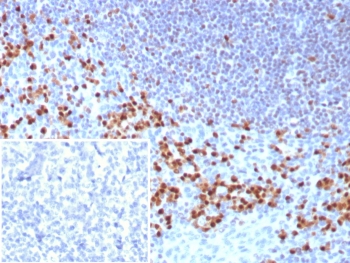 IHC staining of FFPE human t