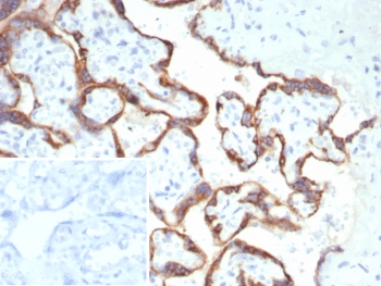 IHC staining of FFPE human placental tissue with HCG-beta antibody (clone hCGa/7870). Inset: PBS used in place of primary Ab (secondary Ab negative control). HIER: boil tissue sections in pH 9 10mM Tris with 1mM EDTA for 20 min and allow to cool before testing.~