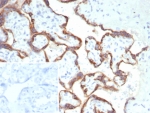 IHC staining of FFPE human placental tissue with HCG-beta antibody (clone hCGa/7870). Inset: PBS used in place of primary Ab (secondary Ab negative control). HIER: boil tissue sections in pH 9 10mM Tris with 1mM EDTA for 20 min and allow to cool before testing.
