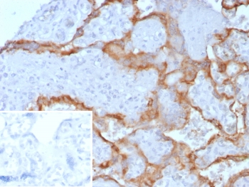 IHC staining of FFPE human placental tissue with HCG-beta antibody (clone hCGa/7872). Inset: PBS used in place of primary Ab (secondary Ab negative control). HIER: boil tissue sections in pH 9 10mM Tris with 1mM EDTA for 20 min and allow to cool before testing.~