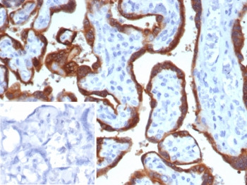 IHC staining of FFPE human placental tissue with HCG-beta antibody (clone hCGa/7875). Inset: PBS used in place of primary Ab (secondary Ab negative control). HIER: boil tissue sections in pH 9 10mM Tris with 1mM EDTA for 20 min and allow to cool before testing.~