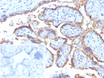 IHC staining of FFPE human placental tissue with HCG-beta antibody (clone rHCGa/6975). Inset: PBS used in place of primary Ab (secondary Ab negative control). HIER: boil tissue sections in pH 9 10mM Tris with 1mM EDTA for 20 min and allow to cool before testing.~