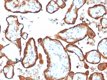 IHC staining of FFPE human placental tissue with HCG-beta antibody (clone HCGa/7806R). HIER: boil tissue sections in pH 9 10mM Tris with 1mM EDTA for 20 min and allow to cool before testing.~