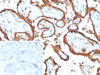 IHC staining of FFPE human placental tissue wit