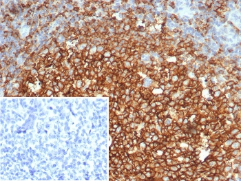 IHC staining of FFPE human tonsil tissue with CD73 antibody (clone NT5E/4679). Inset: PBS used in place of primary Ab (secondary Ab negative control). HIER: boil tissue sections in pH 9 10mM Tris with 1mM EDTA for 20 min and allow to cool before testing.~