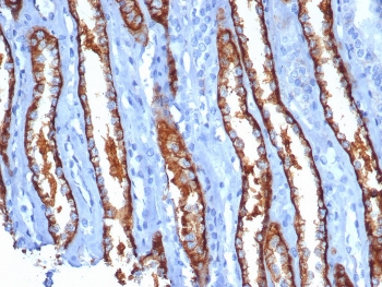 IHC staining of FFPE human kidney tissue with IL20R alpha antibody (clone IL20RA/1752). HIER: boil tissue sections in pH 9 10mM Tris with 1mM EDTA for 20 min and allow to cool before testing.~