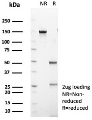 SDS-PAGE analysis of purified, BSA-free IL20R