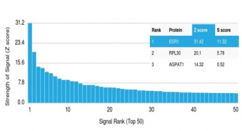 Analysis of a HuProt(TM) microarray containing more than 19,000 full-length human proteins using ER alpha antibody (clone AER311). Z- and S- Score: The Z-score represents the strength of a signal that a monoclonal antibody (in combination with a fluorescently-tagged anti-IgG secondary antibody) produces when