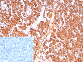 IHC staining of FFPE human pancreas tissue with Carboxypeptidase A1 antibody (clone CPA1/8784). Inset: PBS used in place of primary Ab (secondary Ab negative control). HIER: boil tissue sections in pH 9 10mM Tris with 1mM EDTA for 20 min and allow to cool before testing.