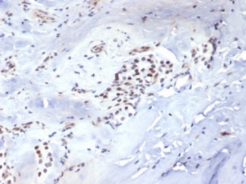 IHC staining of FFPE human parathyroid tissue with Brachyury antibody (clone TBXT/7711R). HIER: boil tissue sections in pH 9 10mM Tris with 1mM EDTA for 20 min and allow to cool before testing.~