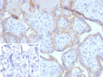IHC staining of FFPE human placental tissue with EGF Receptor antibody (clone EGFR/4616). Inset: PBS used in place of primary Ab (secondary Ab negative control). HIER: boil tissue sections in pH 9 10mM Tris with 1mM EDTA for 20 min and allow to cool before testing.~