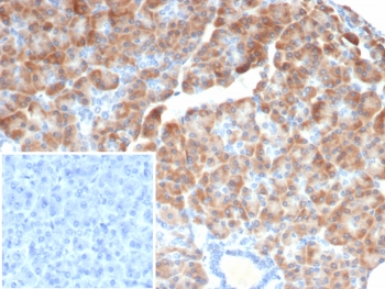 IHC staining of FFPE human pancreas tissue with IL-6 antibody (clone IL6/4642) at 2ug/ml. Inset: PBS used in place of primary Ab (secondary Ab negative control). HIER: boil tissue sections in pH 9 10mM Tris with 1mM EDTA for 20 min and allow to cool before testing.~