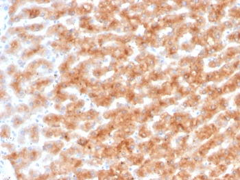 IHC staining of FFPE human liver tissue with Paraoxonase 1 antibody (clone PON1/1351). HIER: boil tissue sections in pH 9 10mM Tris with 1mM EDTA for 20 min and allow to cool before testing.~