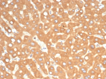 IHC staining of FFPE human liver in colon with EPH Receptor B4 antibody (clone EPHB4/6391). HIER: boil tissue sections in pH 9 10mM Tris with 1mM EDTA for 20 min and allow to cool before testing.~