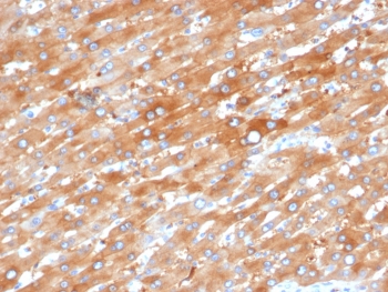 IHC staining of FFPE human liver in colon with EPHB4 antibody (clone EPHB4/6392). HIER: boil tissue sections in pH 9 10mM Tris with 1mM EDTA for 20 min and allow to cool before testing.~