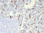 IHC staining of FFPE human pancreas tissue with CFTR antibody (clone rCFTR/8047). Inset: PBS used in place of primary Ab (secondary Ab negative control). HIER: boil tissue sections in pH 9 10mM Tris with 1mM EDTA for 20 min and allow to cool before testing.