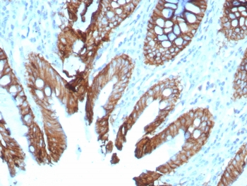 IHC staining of FFPE human colon tissue with Cadherin 17 antibody (clone rCDH17/8512). HIER: boil tissue sections in pH 9 10mM Tris with 1mM EDTA for 20 min and allow to cool before testing.~