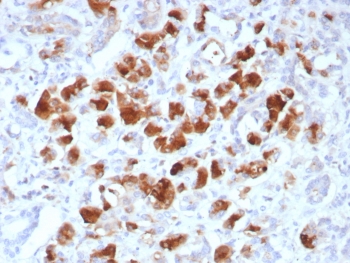 IHC staining of FFPE human pancreas tissue with Carboxypeptidase A1 antibody (clone rCPA1/8518). HIER: boil tissue sections in pH 9 10mM Tris with 1mM EDTA for 20 min and allow to cool before testing.~