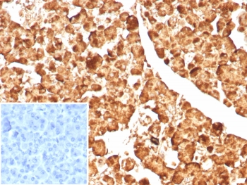 IHC staining of FFPE human pancreas tissue with CPA1 antibody (clone CPA1/8623R). Inset: PBS used in place of primary Ab (secondary Ab negative control). HIER: boil tissue sections in pH 9 10mM Tris with 1mM EDTA for 20 min and allow to cool before testing.~