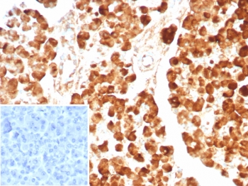 IHC staining of FFPE human pancreas tissue with CPA1 antibody (clone CPA1/8624R). Inset: PBS used in place of primary Ab (secondary Ab negative control). HIER: boil tissue sections in pH 9 10mM Tris with 1mM EDTA for 20 min and allow to cool before testing.~