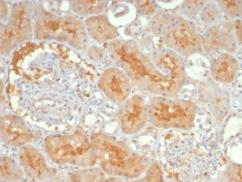 IHC staining of FFPE human kidney tissue with Adenylyl cyclase 8 antibody (clone ADCY8/7341). HIER: boil tissue sections in pH 9 10mM Tris with 1mM EDTA for 20 min and allow to cool before testing.~
