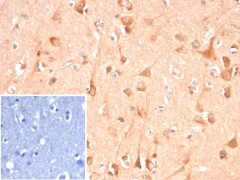 IHC staining of FFPE human brain tissue