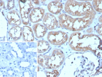 IHC staining of FFPE human kidney tissue with ADCY8 antibody (clone ADCY8/7573). Inset: PBS used in place of primary Ab (secondary Ab negative control). HIER: boil tissue sections in pH 9 10mM Tris with 1mM EDTA for 20 min and allow to cool before testing.~