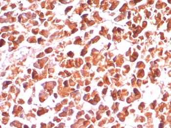 IHC staining of FFPE human pancreas tissue with CPA1 antibody (clone CPA1/8289R). HIER: boil tissue sections in pH 9 10mM Tris with 1mM EDTA for 20 min and allow to cool before testing.~