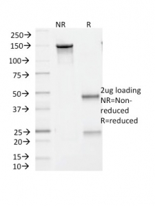 SDS-PAGE analysis of purified, BSA-free BRAF V600E antibody (clone V600E/1321) as confirmation of integrity and purity.
