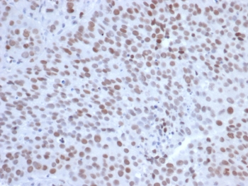 IHC staining of FFPE human tonsil tissue with EZH2 antibody (clone EZH2/6991). HIER: boil tissue sections in pH 9 10mM Tris with 1mM EDTA for 20 min and allow to cool before testing.~