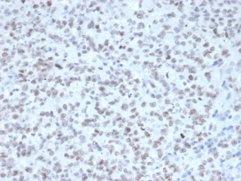 IHC staining of FFPE human tonsil tissue with Enhancer of zeste homolog 2 antibody (clone EZH2/4687). Inset: PBS used in place of primary Ab (secondary Ab negative control). HIER: boil tissue sections in pH 9 10mM Tris with 1mM EDTA for 20 min and allow to cool before testing.~