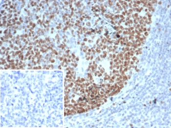 IHC staining of FFPE human tonsil tissue with EZH2 antibody (clone EZH2/6989). Inset: PBS used in place of primary Ab (secondary Ab negative control). HIER: boil tissue sections in pH 9 10mM Tris with 1mM EDTA for 20 min and allow to cool before testing.~