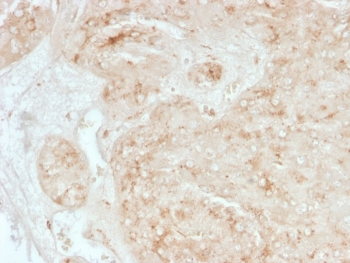 IHC staining of FFPE human adrenal gland tissue with StAR antibody (clone STAR/3976). HIER: boil tissue sections in pH 9 10mM Tris with 1mM EDTA for 20 min and allow to cool before testing.~