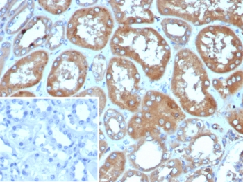 IHC staining of FFPE human kidney tissue with Deleted in breast cancer 2 antibody (clone DBC2/4570). Inset: PBS used in place of primary Ab (secondary Ab negative control). HIER: boil tissue sections in pH 9 10mM Tris with 1mM EDTA for 20 min and allow to cool before testing.~