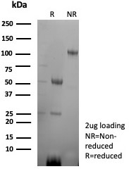 SDS-PAGE analysis of purified, BSA-free CA8 antibody (clone rCA8/8835) as confirmation of integrity and purity.