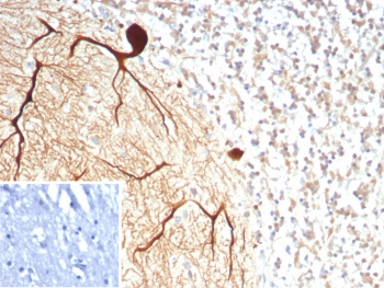 IHC staining of FFPE human brain tissue with Carbonic Anhydrase VIII antibody (clone CA8/8605R). Inset: PBS used in place of primary Ab (secondary Ab negative control). HIER: boil tissue sections in pH 9 10mM Tris with 1mM EDTA for 20 min and allow to cool before testing.~
